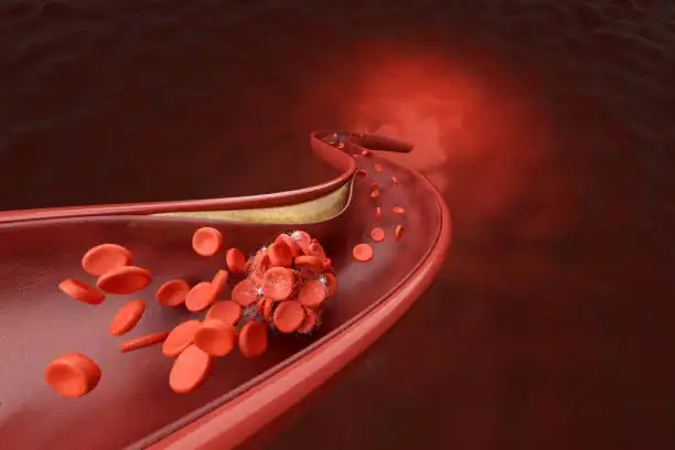 Does lycopene lower cholesterol?